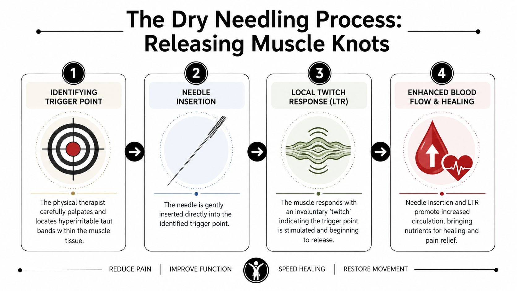 A step-by-step infographic illustrating the dry needling process for identifying and releasing muscle knots in tissue.